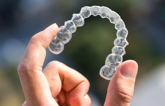 How Much is Invisalign Reddit